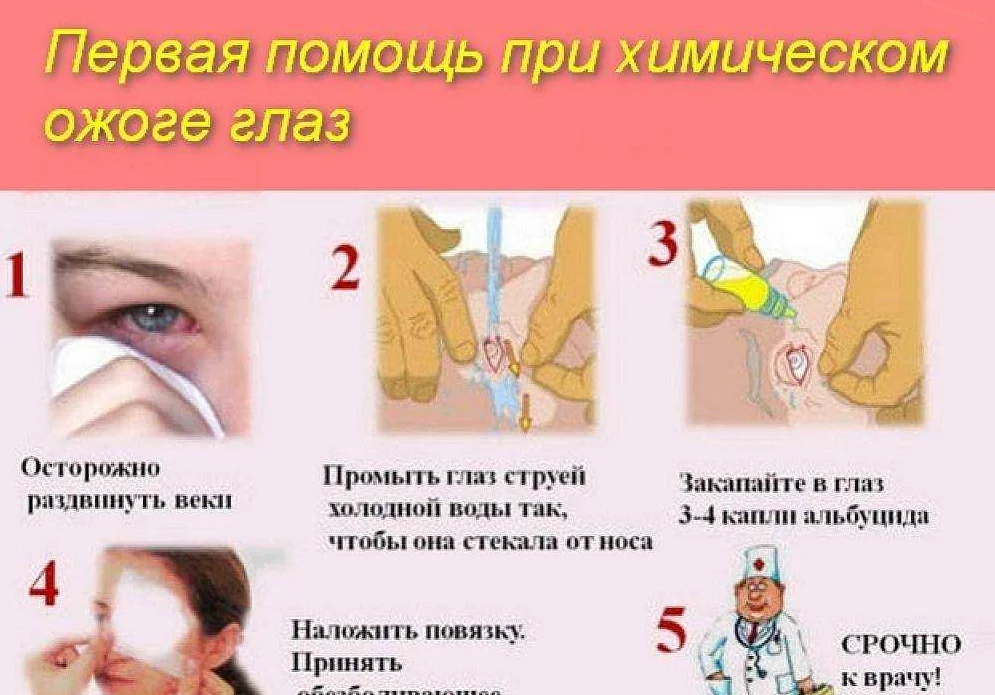 Ожог глаз кварцевой и ультрафиолетовой лампой: что делать